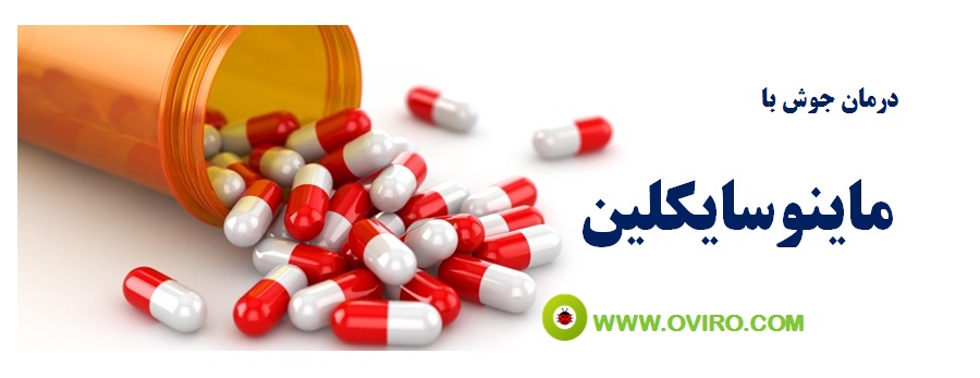 درمان جوش با ماینوسایکلین ( minocycline )