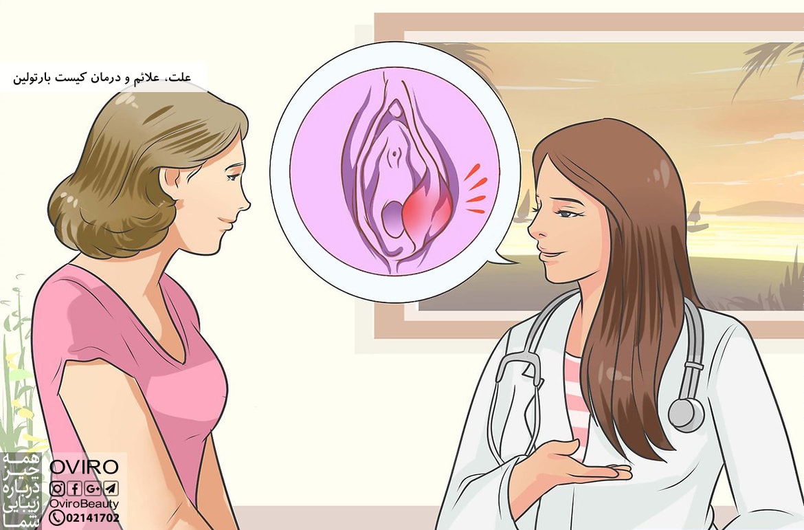 علت، علائم و درمان کیست بارتولین