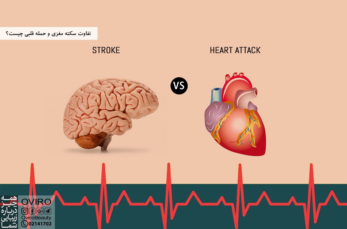 تفاوت سکته مغزی و حمله قلبی چیست؟