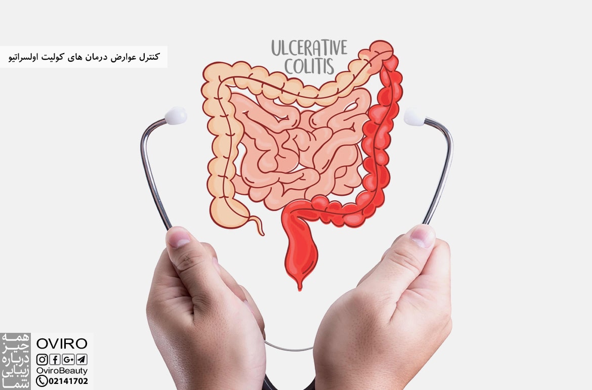 کنترل عوارض درمان های کولیت اولسراتیو