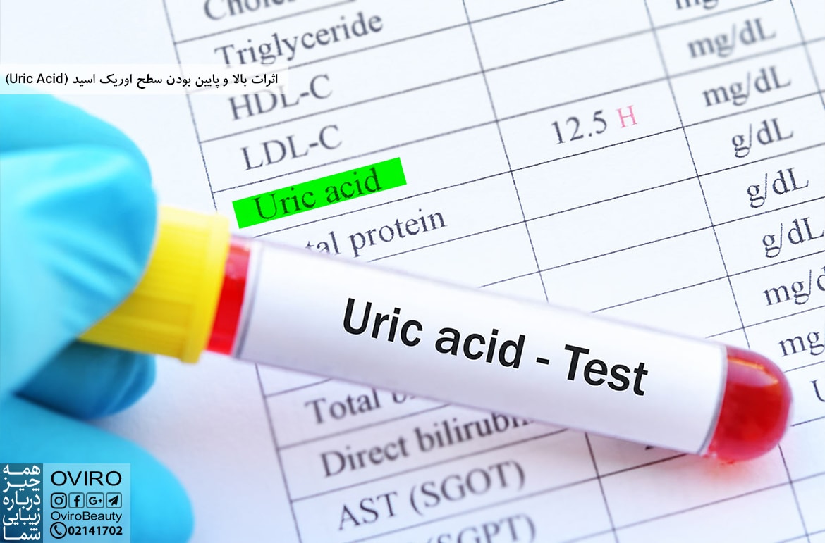 اثرات بالا و پایین بودن سطح اوریک اسید (Uric Acid)