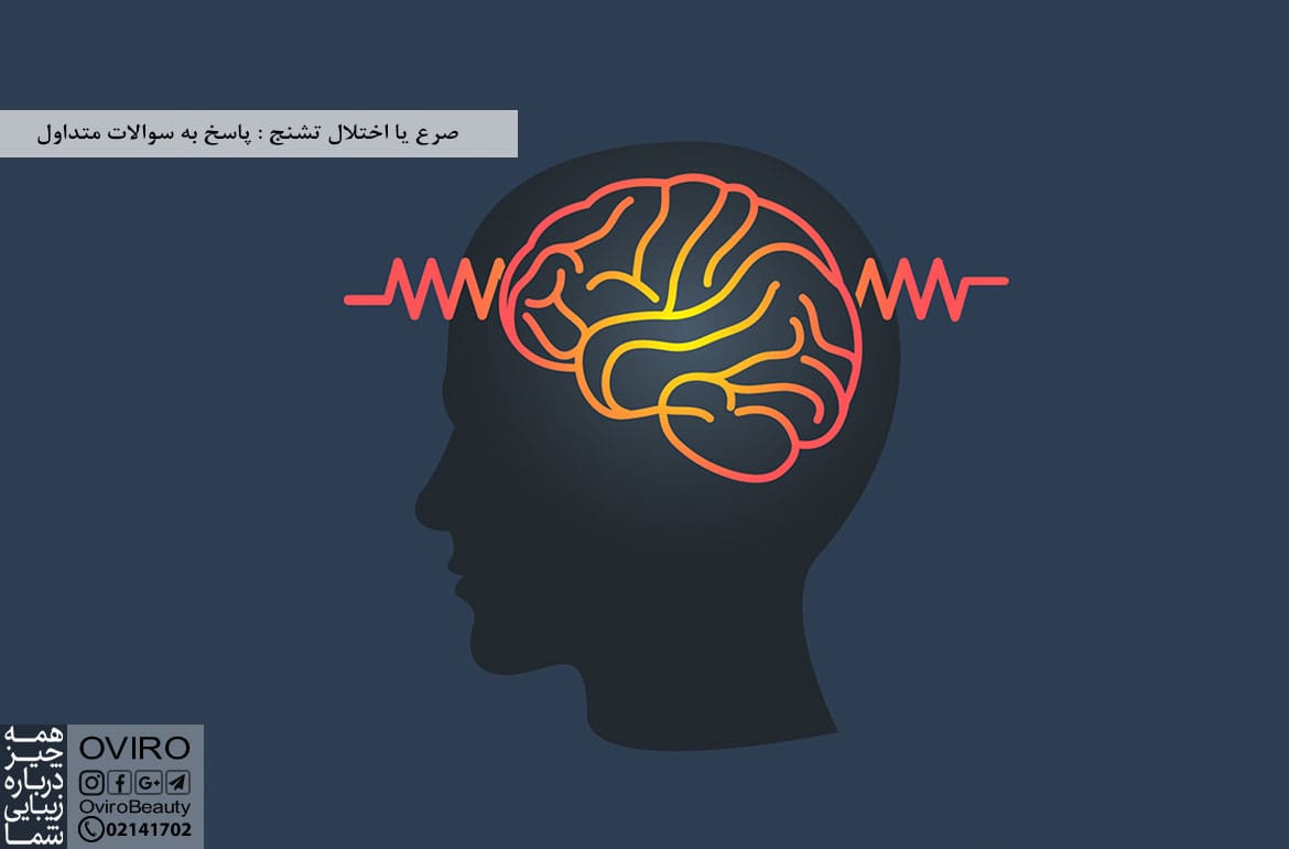 صرع یا اختلال تشنج : پاسخ به سوالات متداول