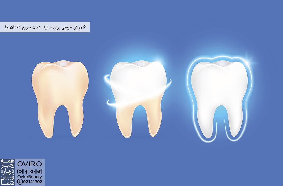 6 روش طبیعی برای سفید شدن سریع دندان ها