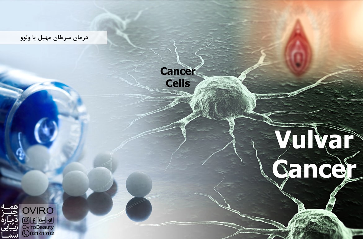 درمان سرطان مهبل