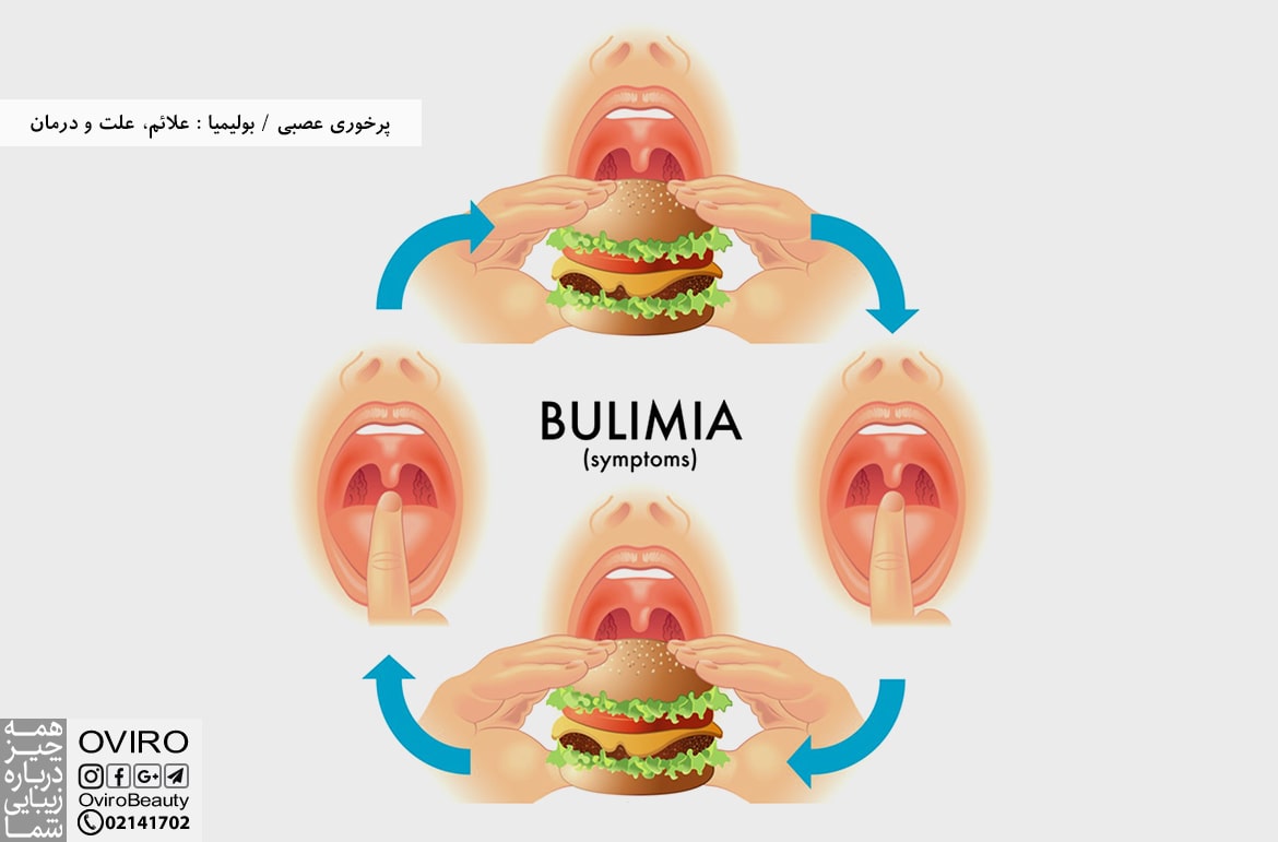 پرخوری عصبی / بولیمیا : علائم، علت و درمان