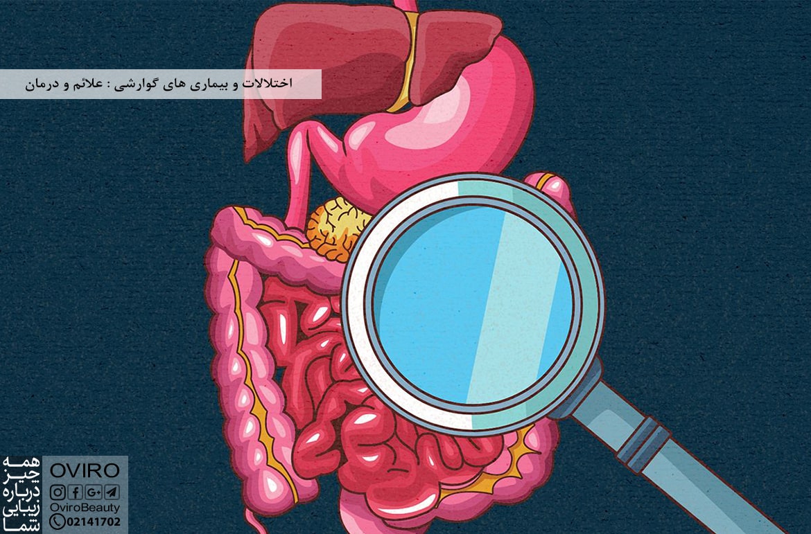 اختلالات و بیماری گوارشی