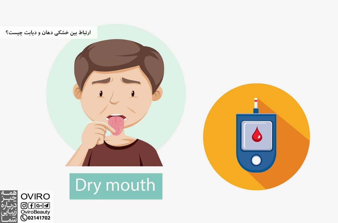 ارتباط بین خشکی دهان و دیابت چیست؟