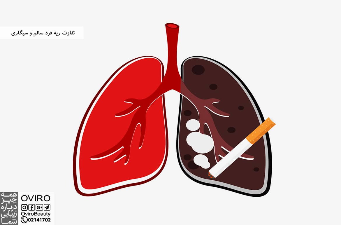 تفاوت ریه فرد سالم و سیگاری