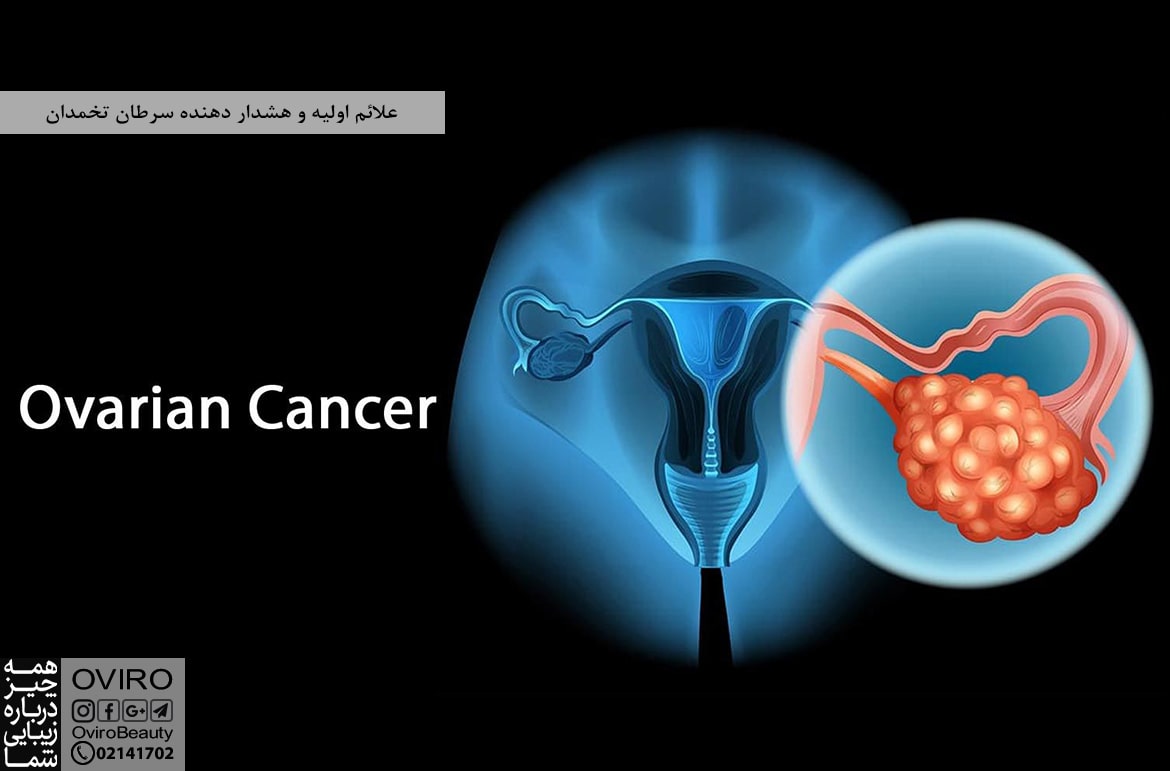 علائم اولیه و هشدار دهنده سرطان تخمدان