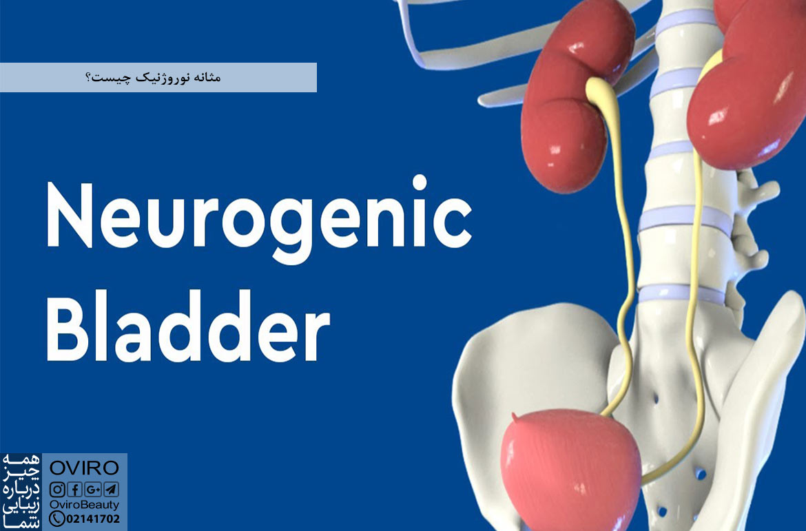 مثانه نوروژنیک چیست؟ علت - انواع - علائم و درمان | مثانه عصبی | اختلال عصبی مثانه