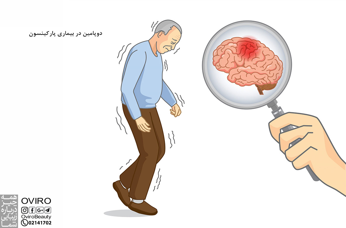 دوپامین در بیماری پارکینسون | میزان دوپامین در پارکینسون | علت ابتلا و تشخیص بیماری