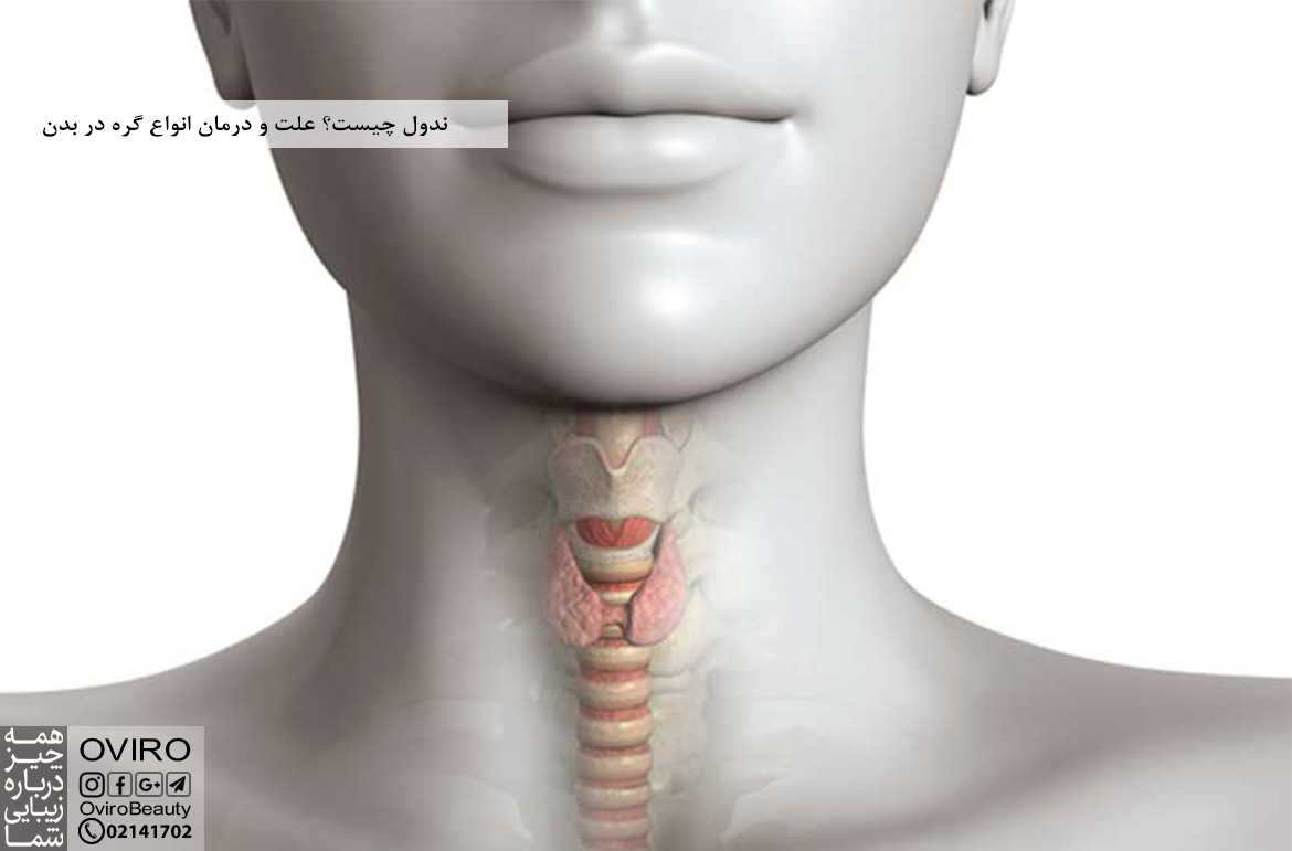 ندول چیست؟ علت و درمان انواع گره در بدن : غدد لنفاوی - تیروئید - تارهای صوتی و ریه