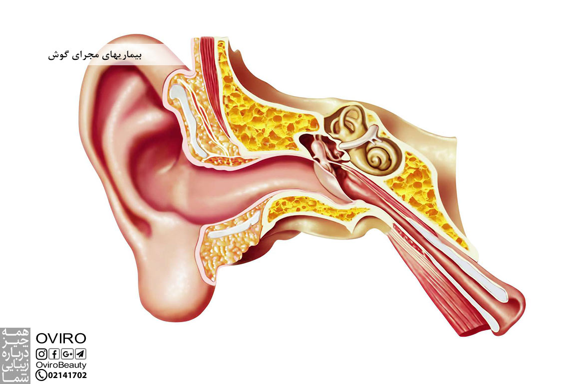بیماریهای مجرای گوش | تنگی و بسته شدن مجرای گوش | راه های مراقبت از گوش