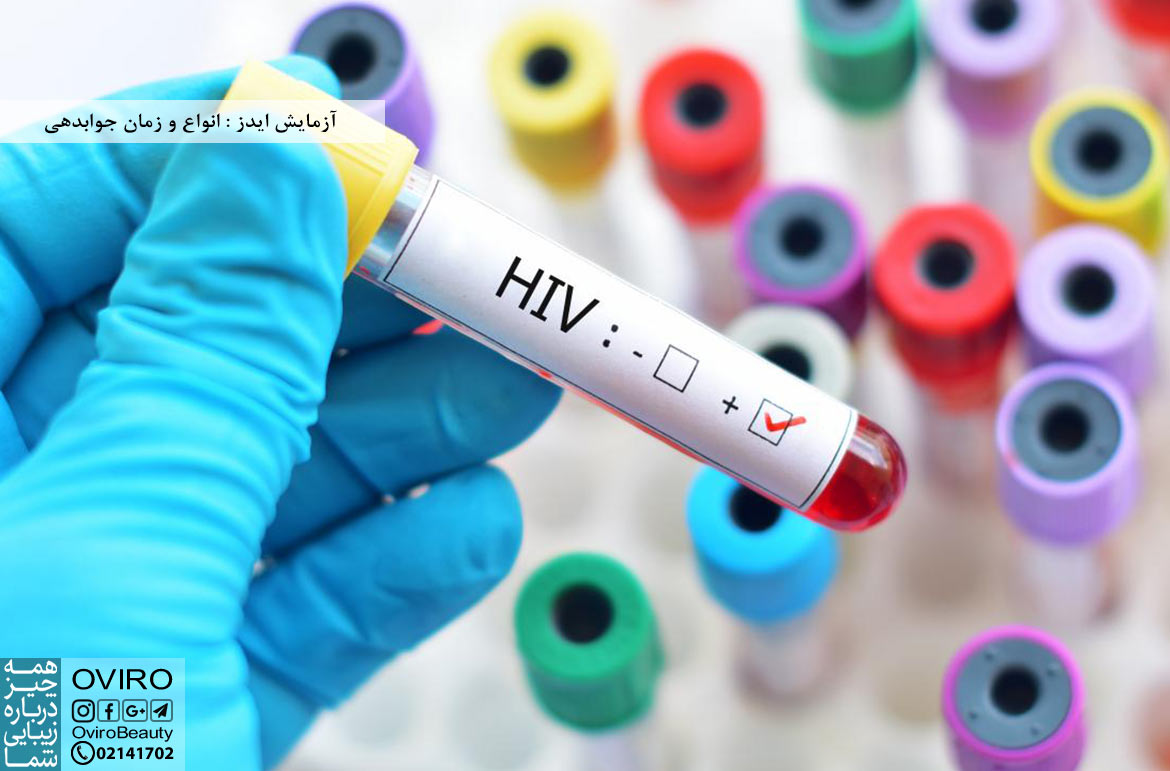 آزمایش ایدز : انواع و زمان جوابدهی | محل انجام آزمایش HIV | آزمایش تشخیص ایدز در خانه