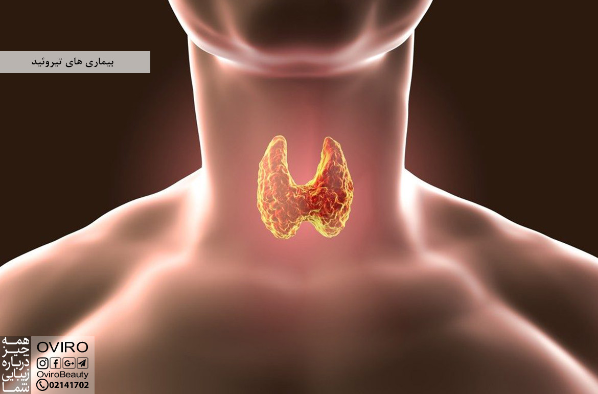 بیماری های تیروئید : علائم - درمان - پیشگیری | عملکرد غده تیروئید | اویرو مگ
