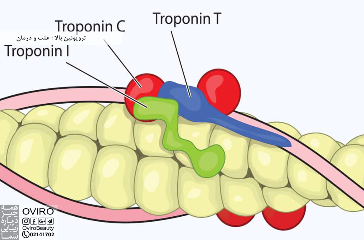 تروپونین بالا : علت - درمان | مقدار نرمال سطح تروپونین | آزمایش تروپونین