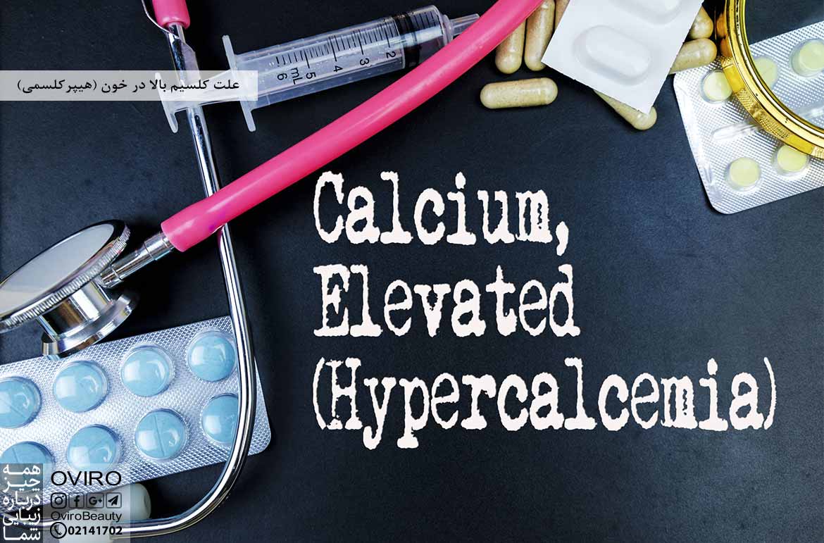 علت کلسیم بالا در خون (هیپرکلسمی) - درمان - علائم - عوارض - تشخیص - پیشگیری