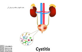 علت التهاب مثانه و درمان آن : علائم - انواع و راه های تشخیص سیستیت مثانه
