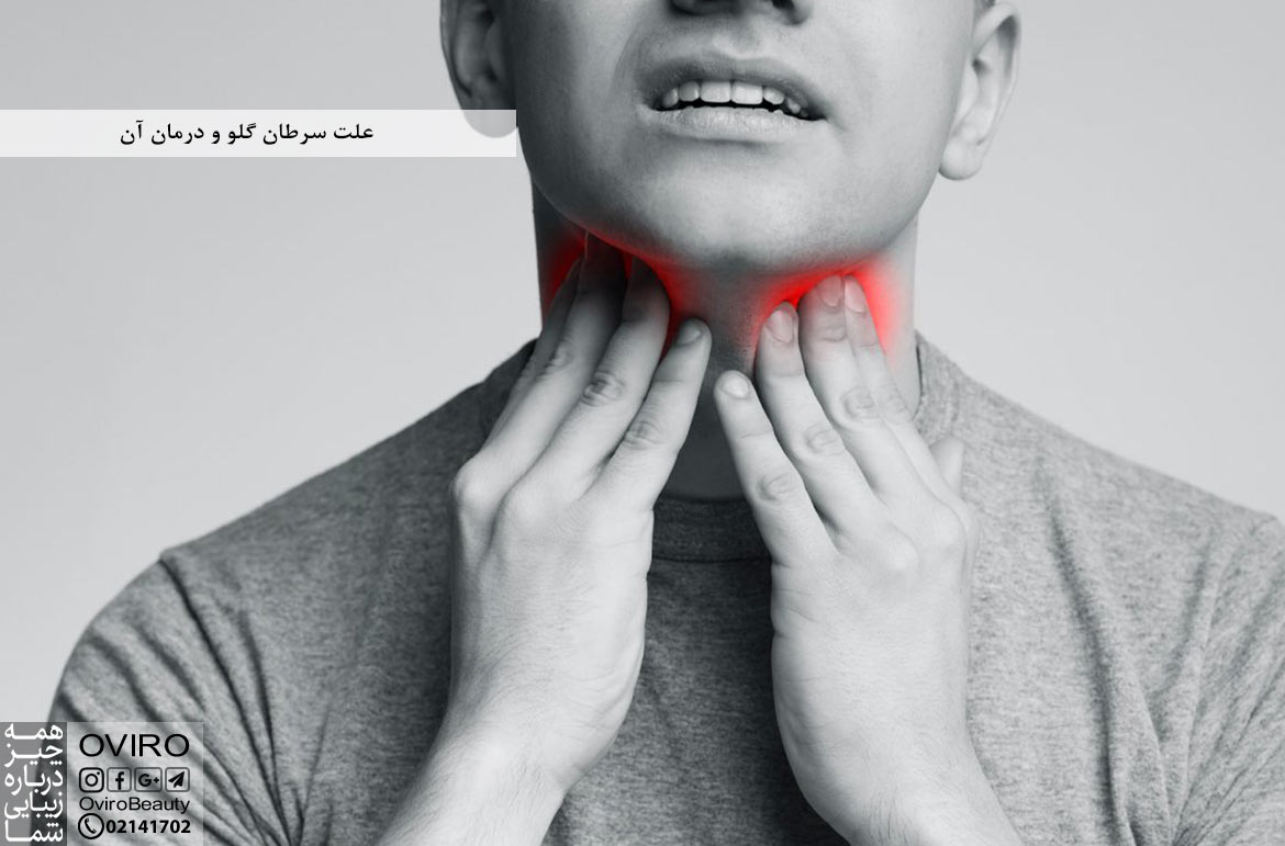 علت سرطان گلو و درمان آن : علائم - راه های تشخیص و طول عمر بیماران | اویرو
