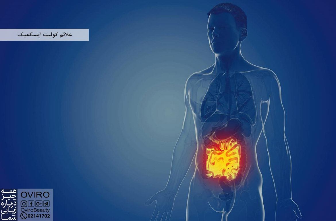 علائم کولیت ایسکمیک : علت - عوامل خطر - تشخیص - عوارض | ایسکمی روده بزرگ