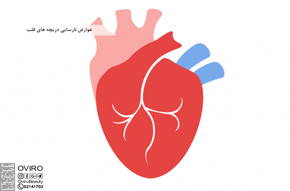 عوارض نارسایی دریچه های قلب : انواع - علت - عوامل خطر - تشخیص - درمان