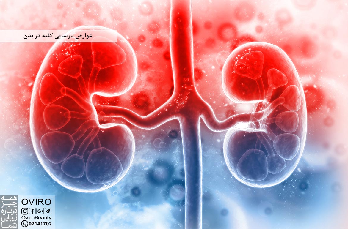 عوارض نارسایی کلیه در بدن : علائم - علت - تشخیص | داروخانه آنلاین اویرو