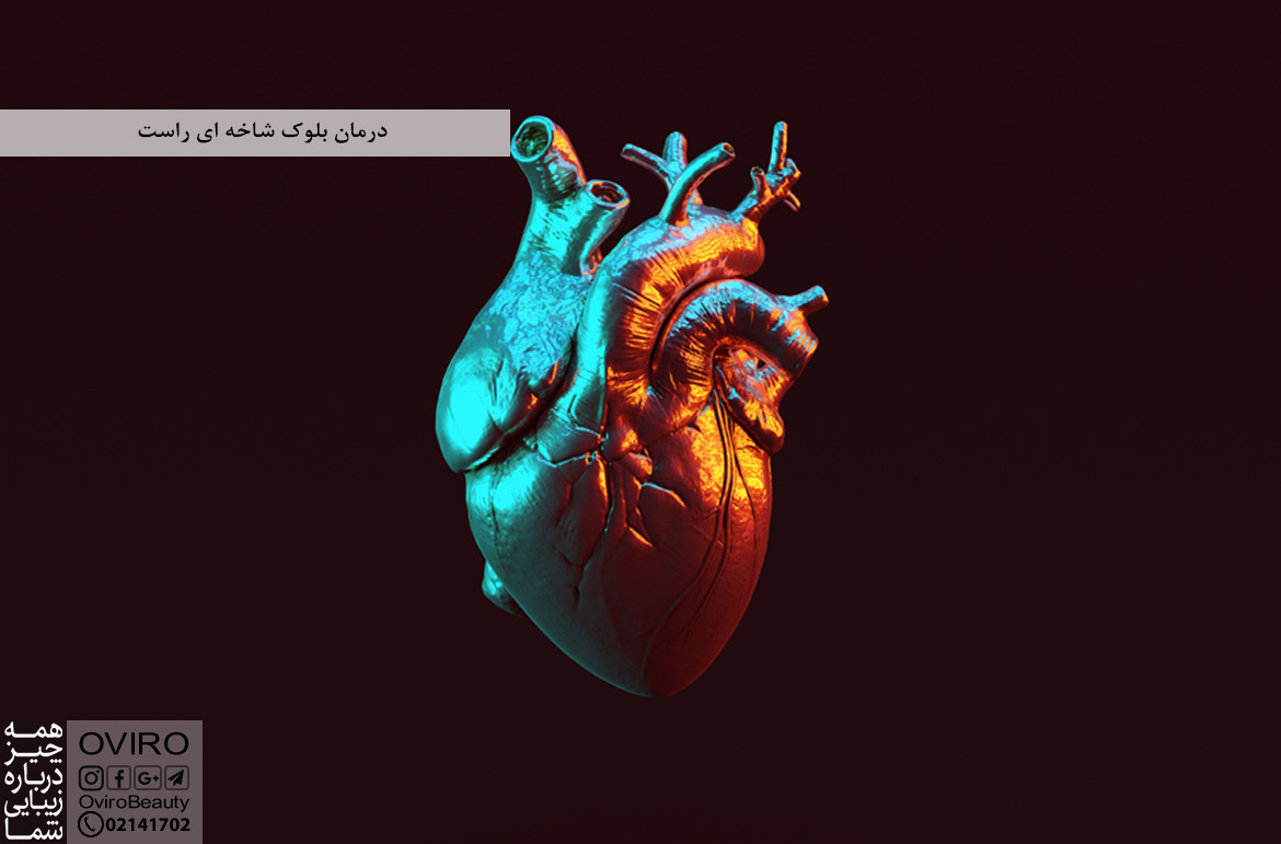 درمان بلوک شاخه ای راست (RBBB) : علائم - علت - تشخیص - عوارض