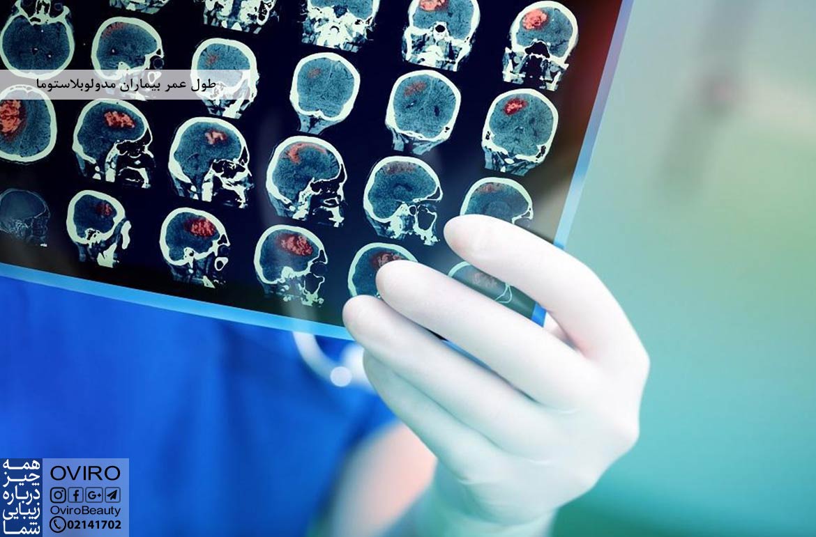 طول عمر بیماران تومور مغزی مدولوبلاستوما : علائم - علت - تشخیص | اویرو مگ