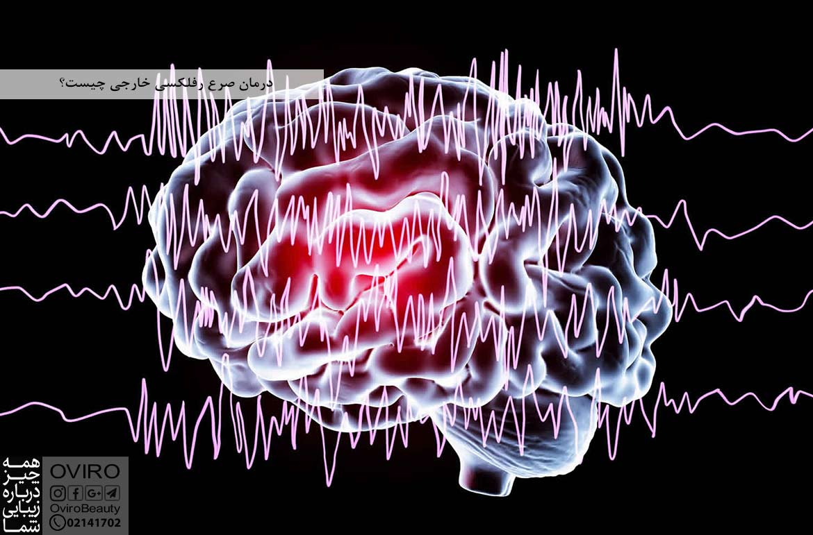 درمان صرع رفلکسی (اپی لپسی) خارجی : انواع - علت - تشخیص | اویرو مگ